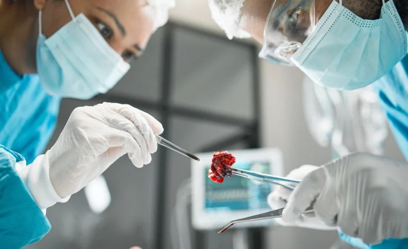 Contemporary Scholars on Organ Transplantation